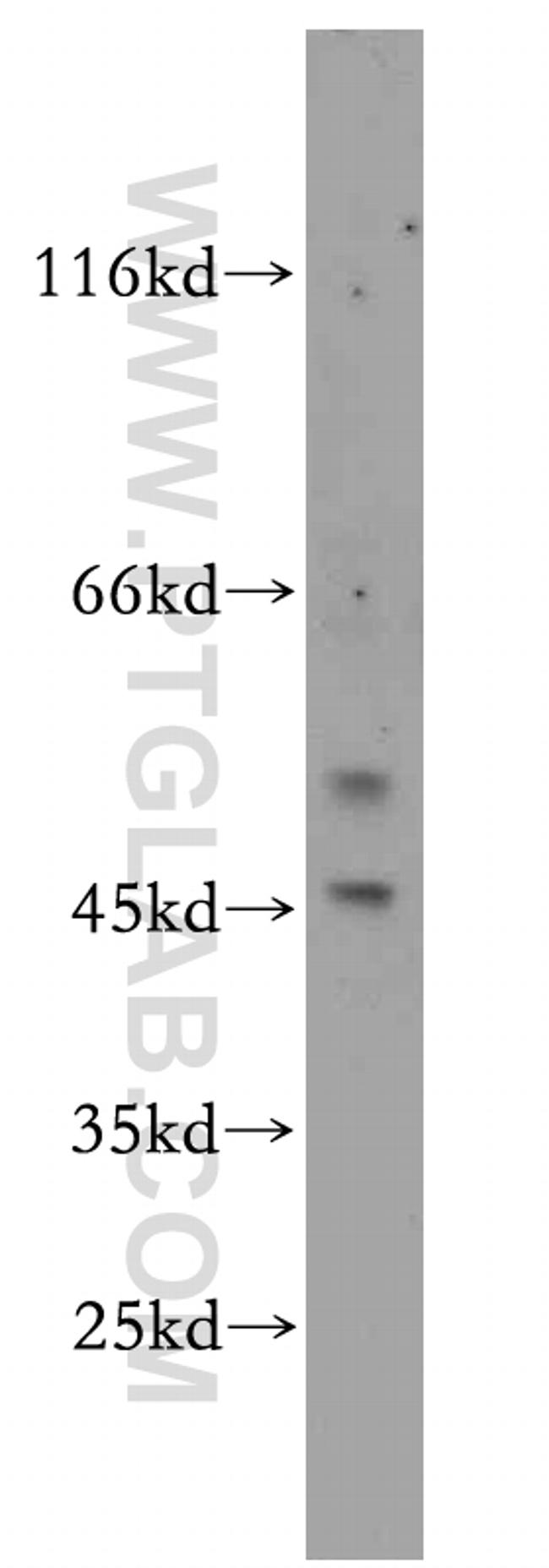EYA2 Antibody in Western Blot (WB)
