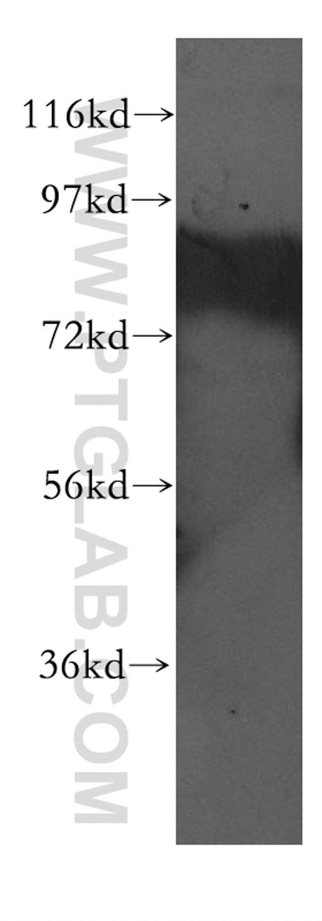 CBFA2T2 Antibody in Western Blot (WB)