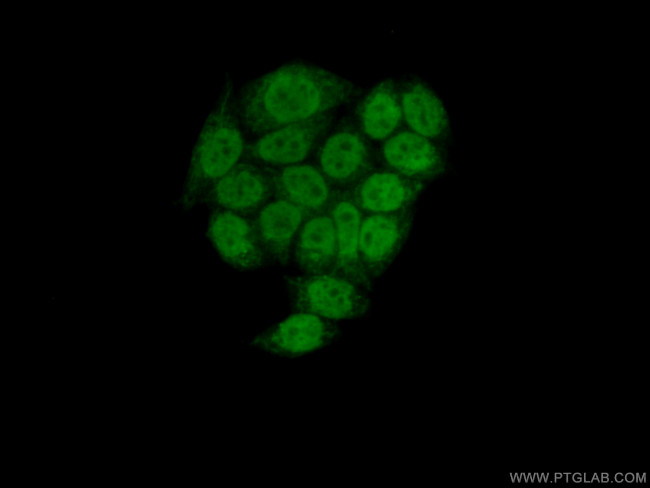 NSD3 Antibody in Immunocytochemistry (ICC/IF)