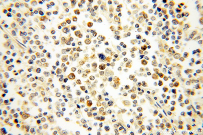 NSD3 Antibody in Immunohistochemistry (Paraffin) (IHC (P))