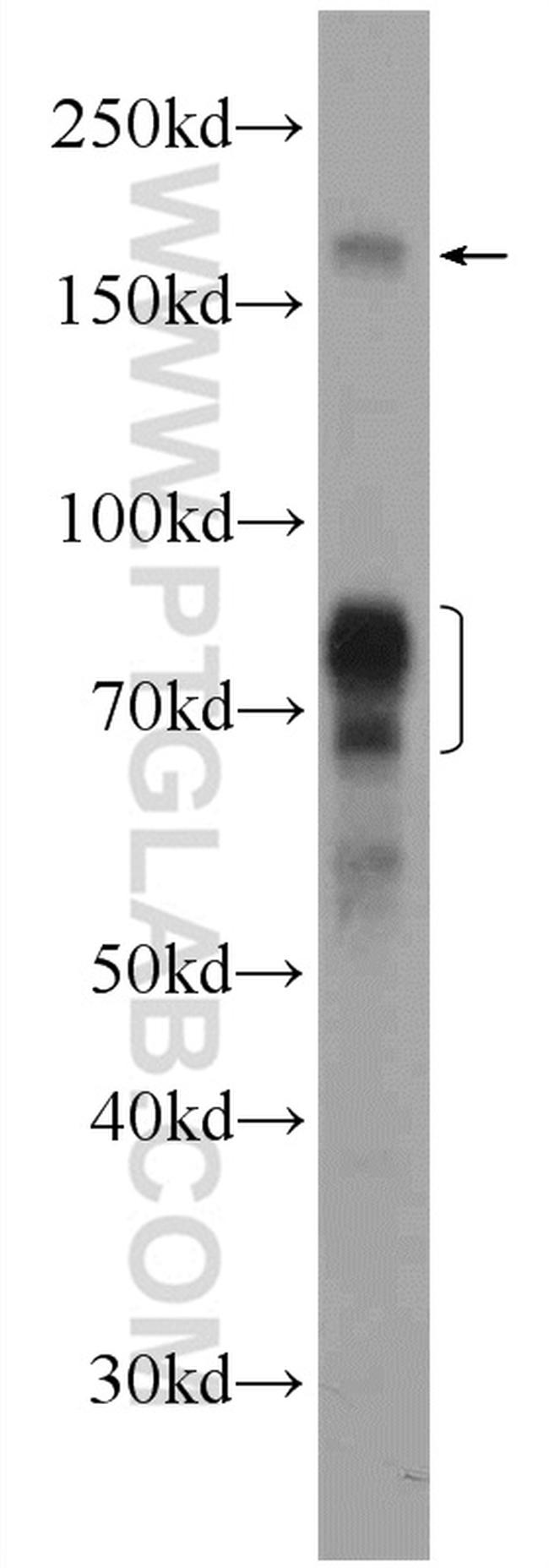 NSD3 Antibody in Western Blot (WB)