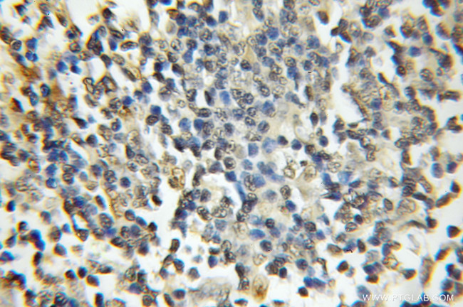 DDX1 Antibody in Immunohistochemistry (Paraffin) (IHC (P))