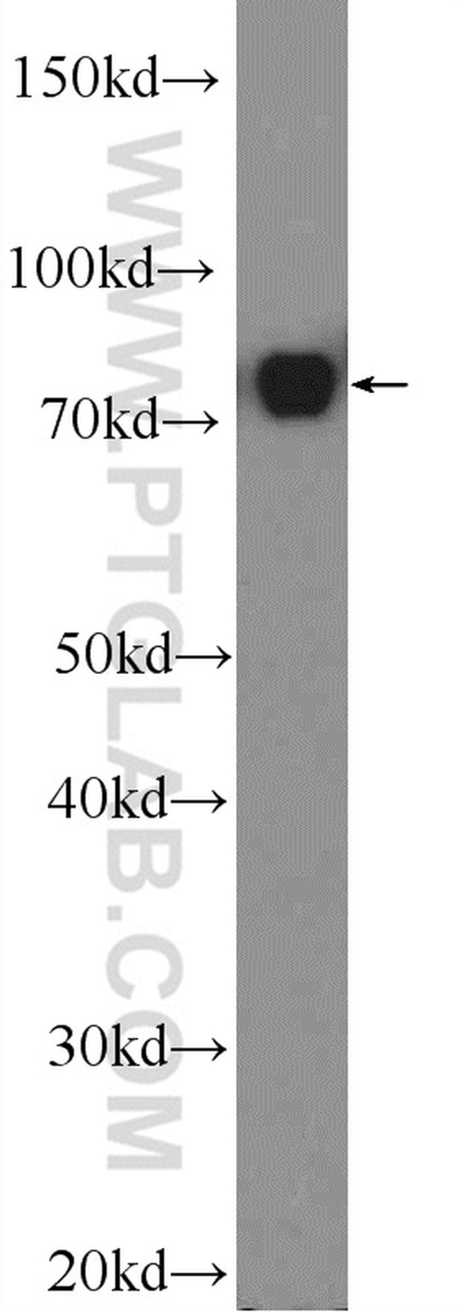 DEF6 Antibody in Western Blot (WB)