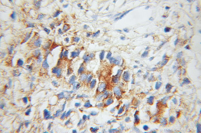 UBE2D1 Antibody in Immunohistochemistry (Paraffin) (IHC (P))