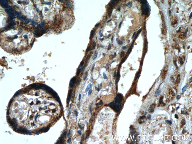 FH Antibody in Immunohistochemistry (Paraffin) (IHC (P))