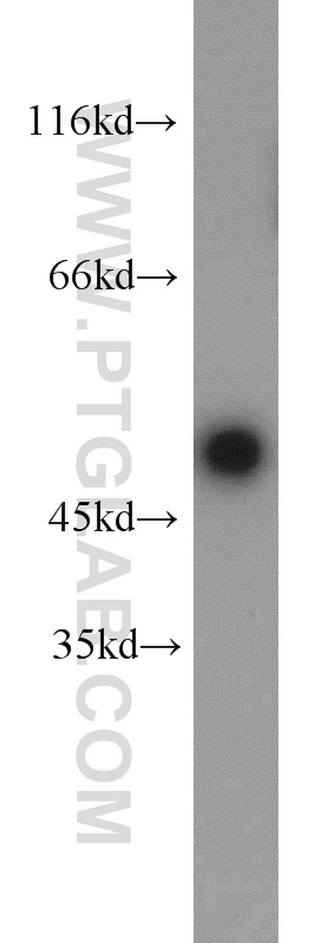 FH Antibody in Western Blot (WB)