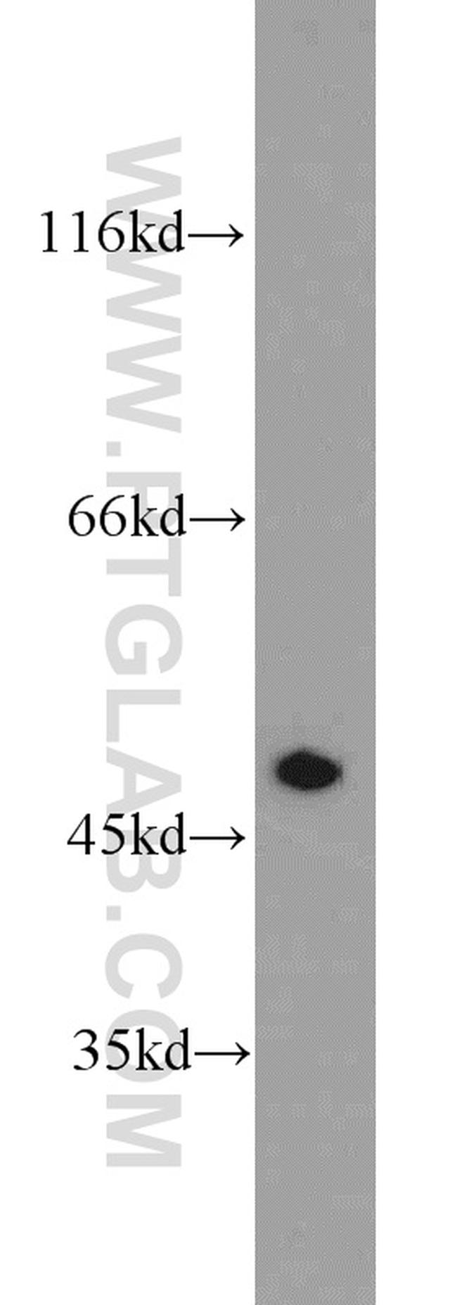 FH Antibody in Western Blot (WB)