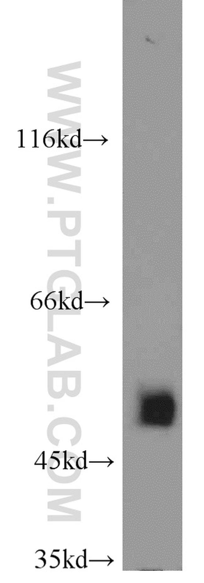 FH Antibody in Western Blot (WB)