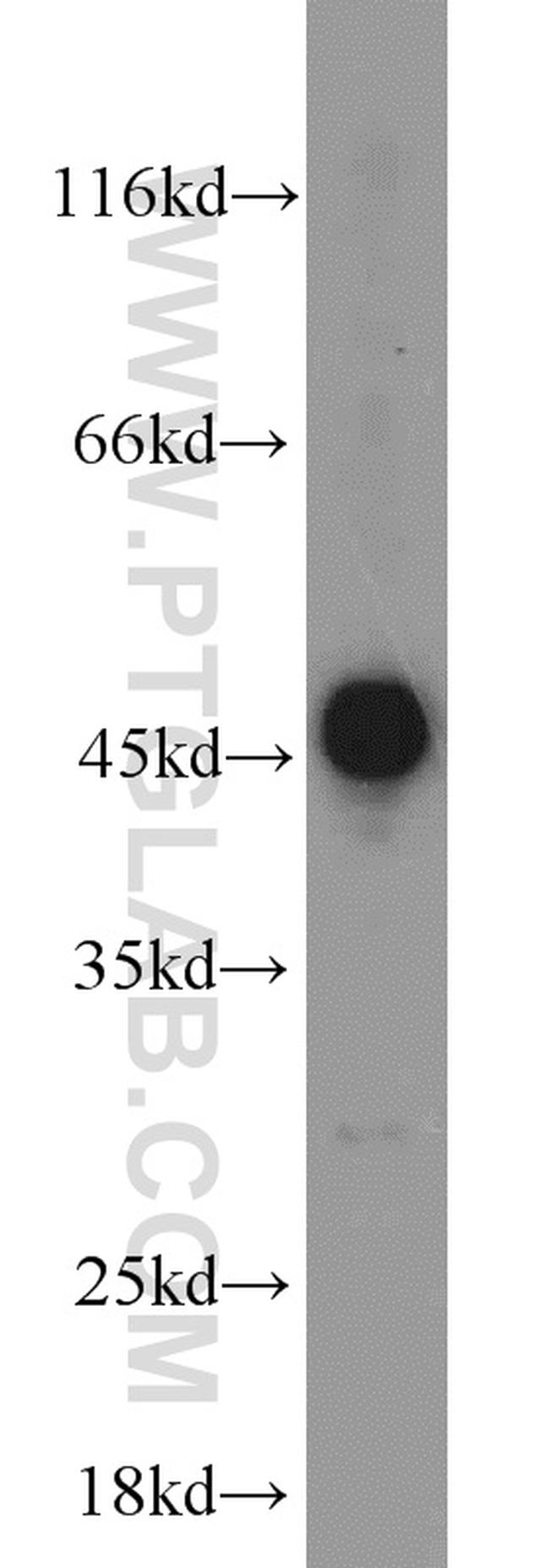 FH Antibody in Western Blot (WB)