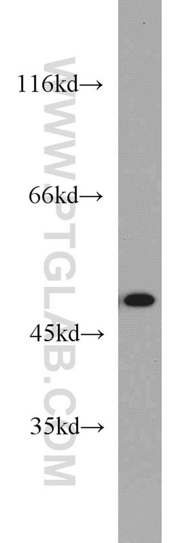 FH Antibody in Western Blot (WB)