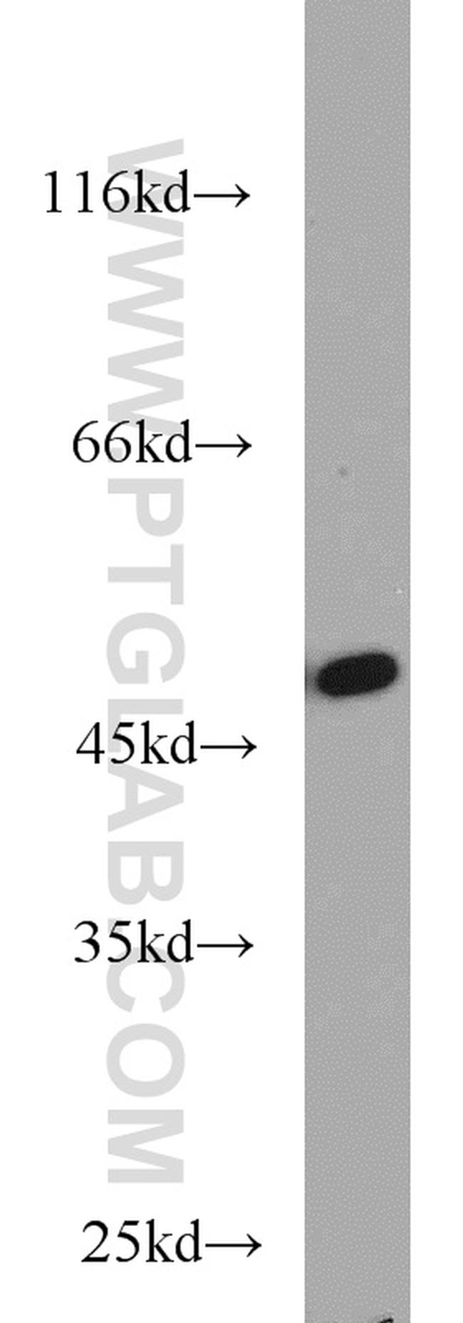 FH Antibody in Western Blot (WB)