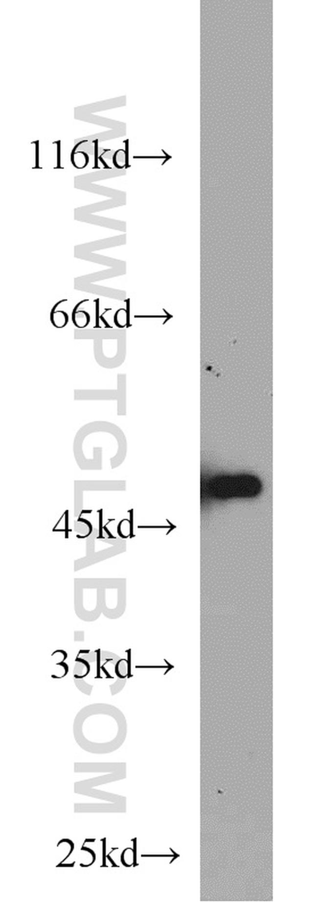 FH Antibody in Western Blot (WB)