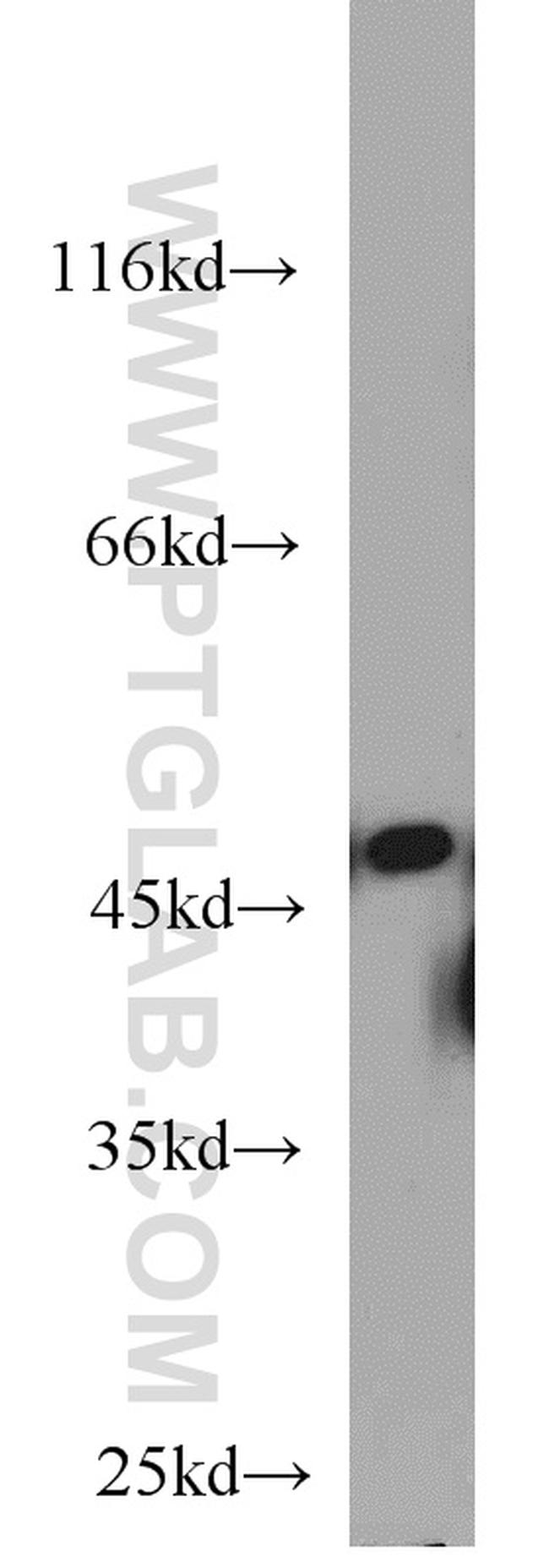 FH Antibody in Western Blot (WB)