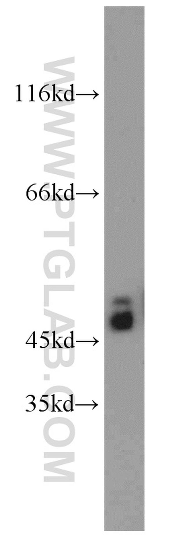 FH Antibody in Western Blot (WB)