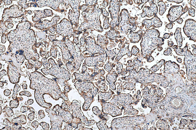 FH Antibody in Immunohistochemistry (Paraffin) (IHC (P))