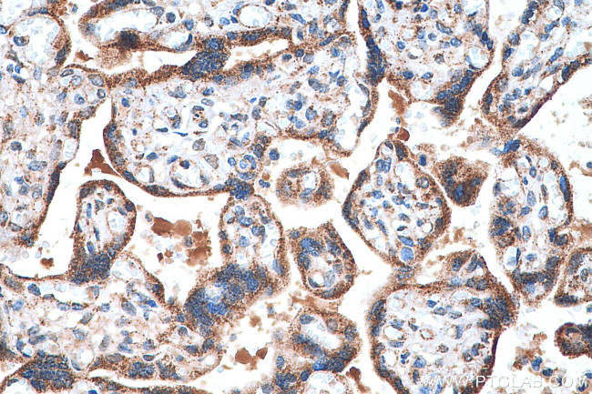 FH Antibody in Immunohistochemistry (Paraffin) (IHC (P))