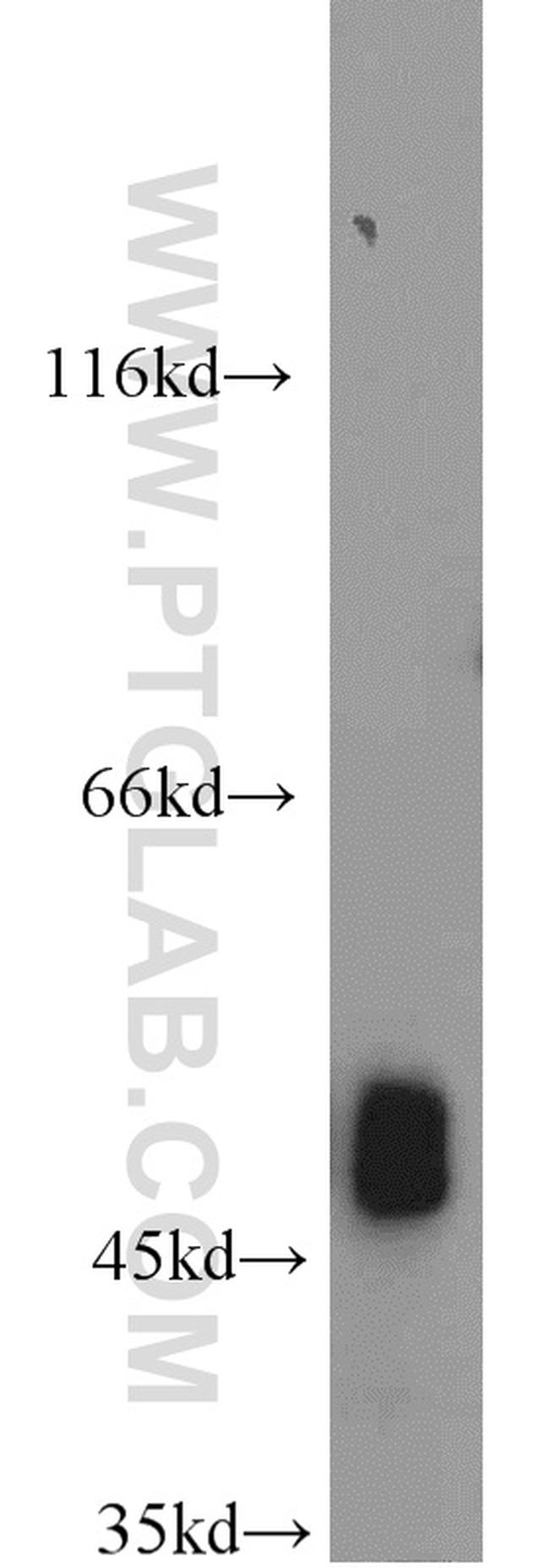 FH Antibody in Western Blot (WB)