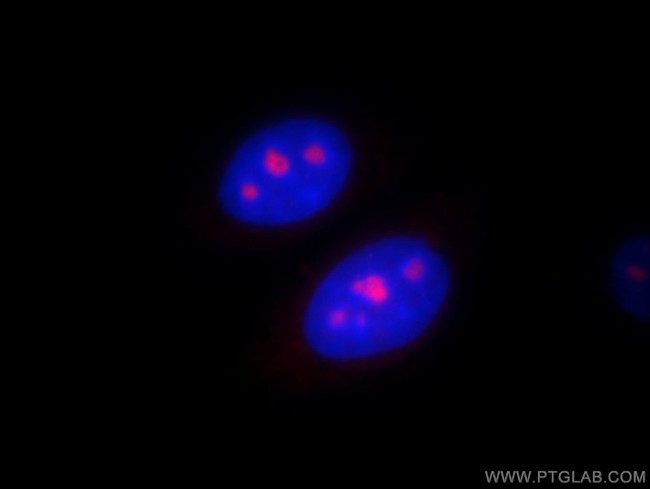 PSMC4 Antibody in Immunocytochemistry (ICC/IF)