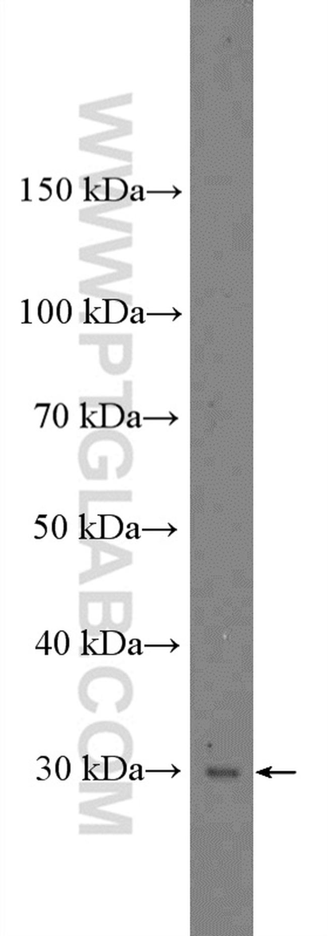 NMNAT1 Antibody in Western Blot (WB)