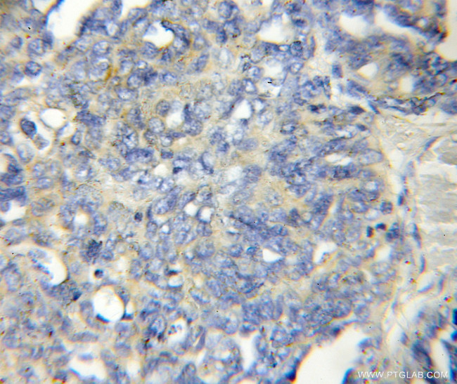 LENG1 Antibody in Immunohistochemistry (Paraffin) (IHC (P))