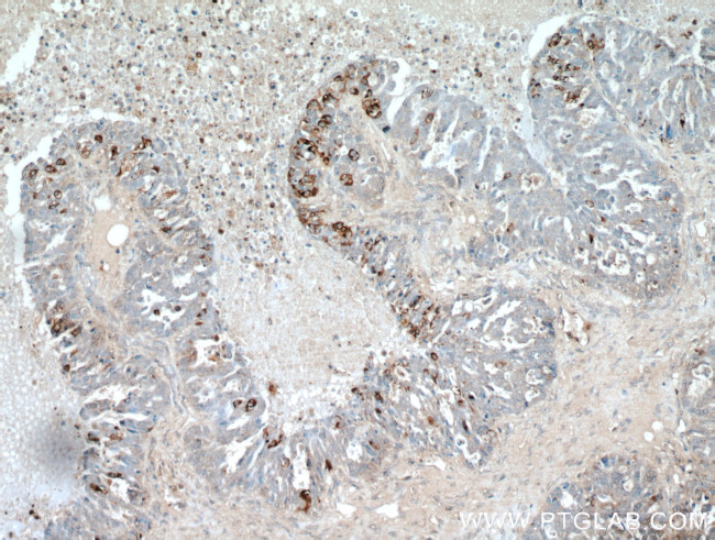 COX7A2L Antibody in Immunohistochemistry (Paraffin) (IHC (P))