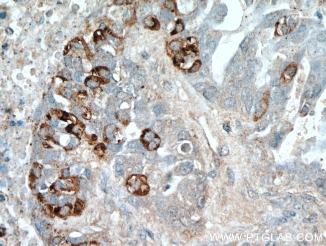 COX7A2L Antibody in Immunohistochemistry (Paraffin) (IHC (P))