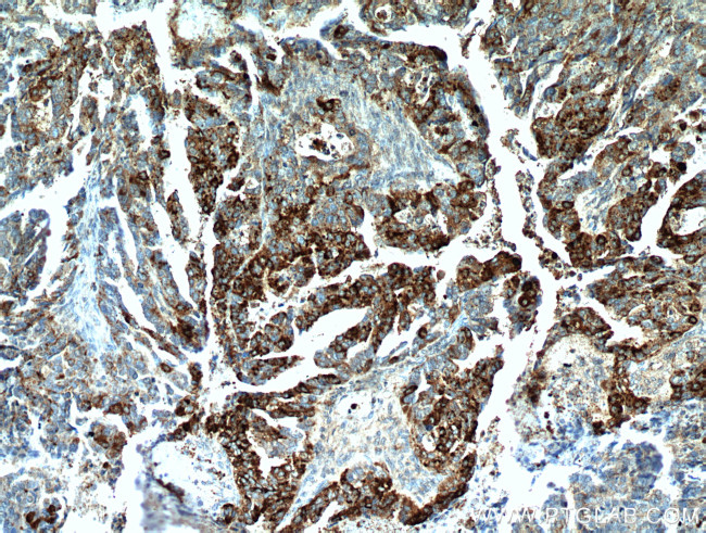 COX7A2L Antibody in Immunohistochemistry (Paraffin) (IHC (P))