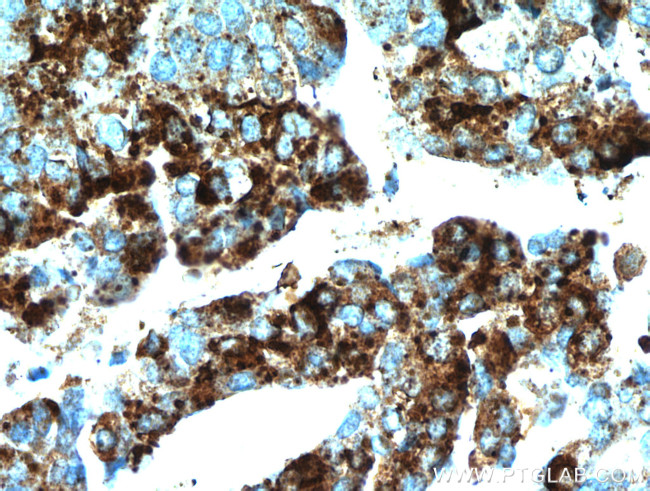 COX7A2L Antibody in Immunohistochemistry (Paraffin) (IHC (P))