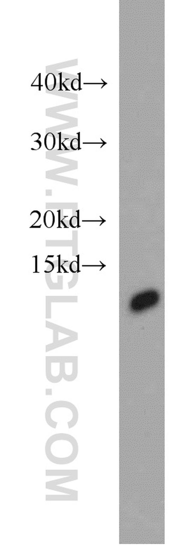 COX7A2L Antibody in Western Blot (WB)