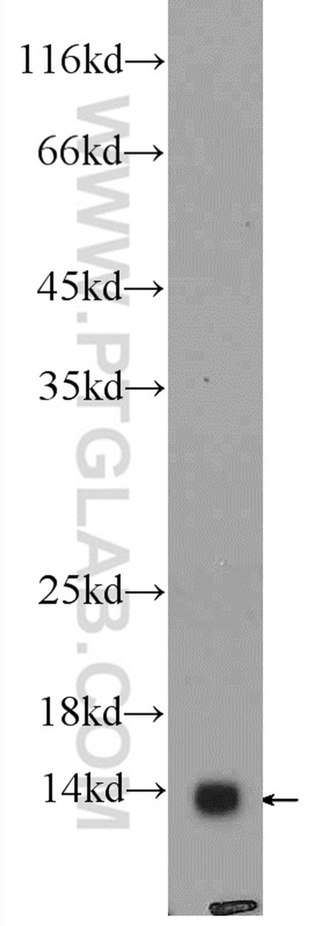 COX7A2L Antibody in Western Blot (WB)