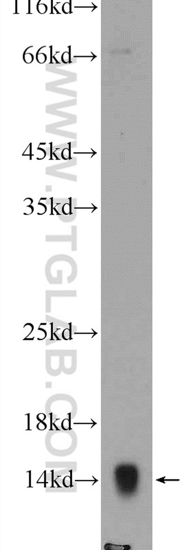 COX7A2L Antibody in Western Blot (WB)