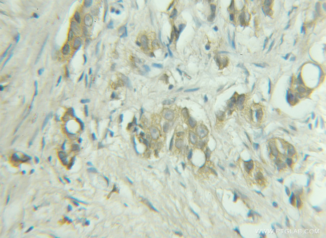 RAB9A Antibody in Immunohistochemistry (Paraffin) (IHC (P))