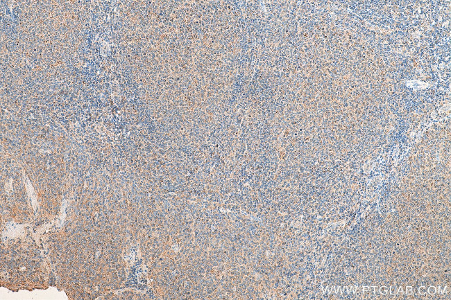 RAB9A Antibody in Immunohistochemistry (Paraffin) (IHC (P))