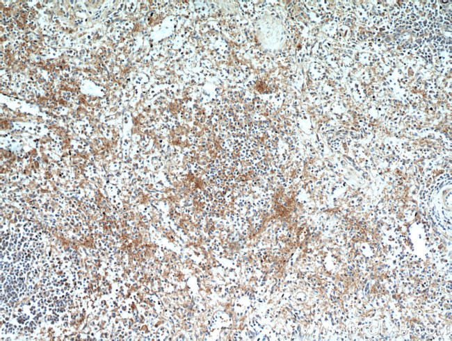 RAB9A Antibody in Immunohistochemistry (Paraffin) (IHC (P))