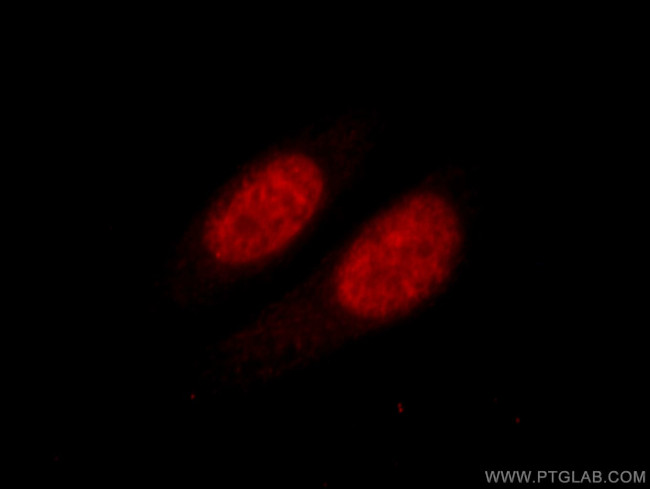 HNRNPK Antibody in Immunocytochemistry (ICC/IF)