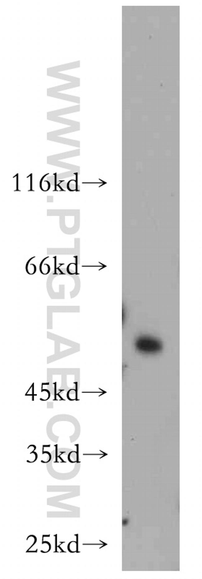 SESN3 Antibody in Western Blot (WB)