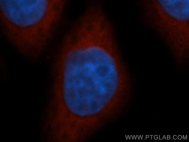 NQO1 Antibody in Immunocytochemistry (ICC/IF)