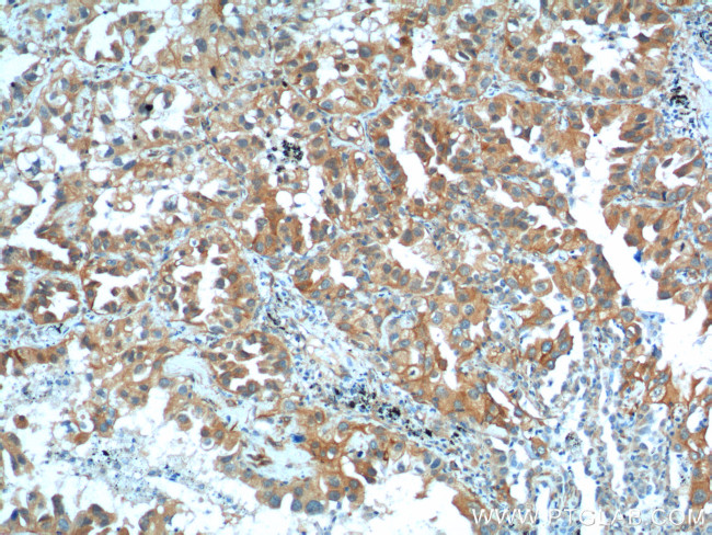 S100A16 Antibody in Immunohistochemistry (Paraffin) (IHC (P))