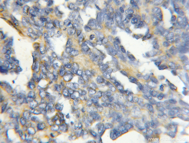 COX4I2 Antibody in Immunohistochemistry (Paraffin) (IHC (P))