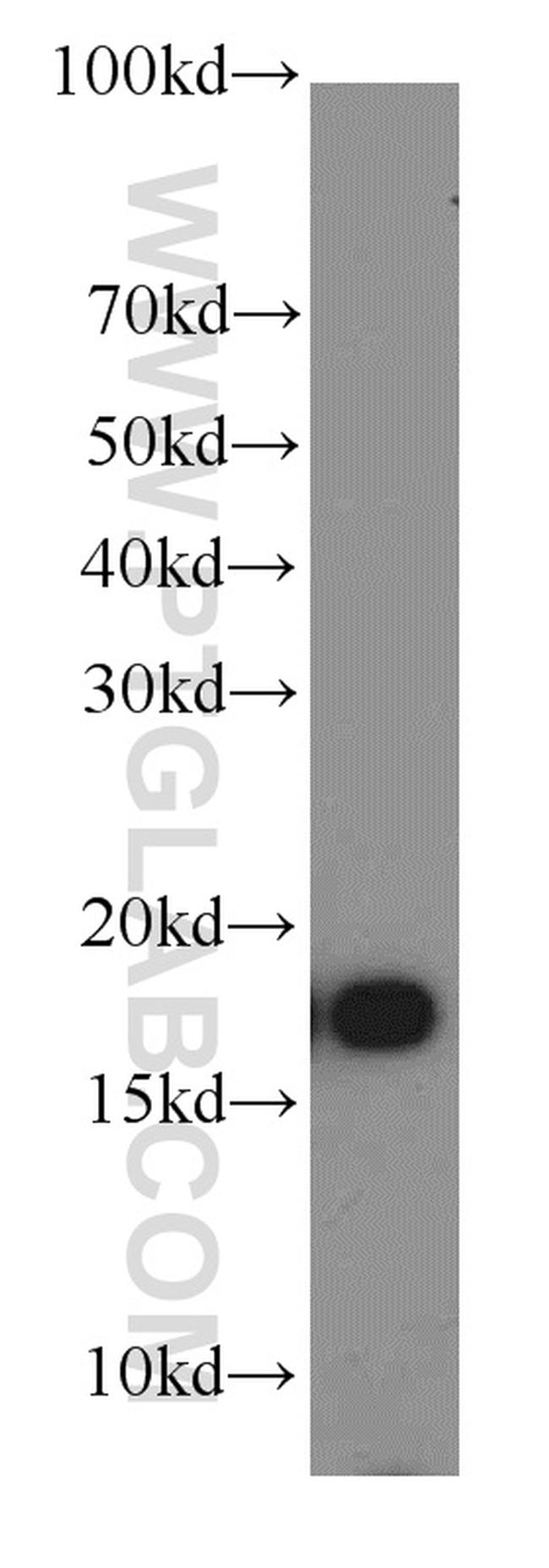 COX4I2 Antibody in Western Blot (WB)