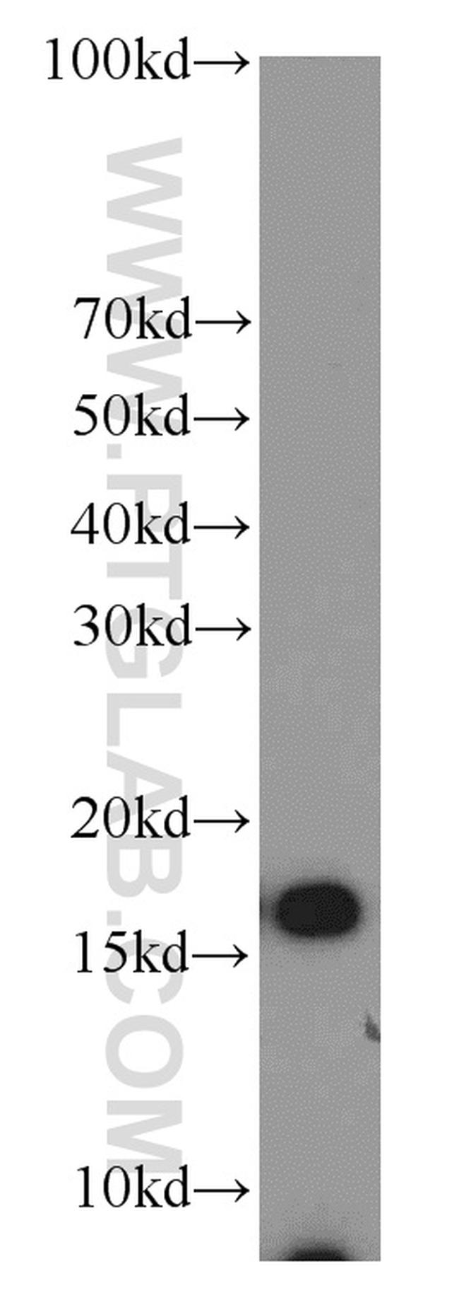 COX4I2 Antibody in Western Blot (WB)