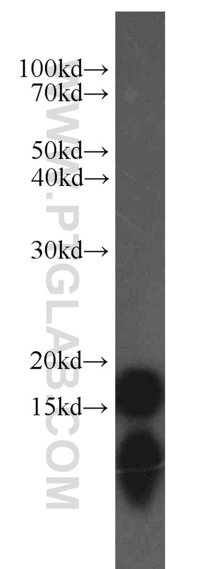 COX4I2 Antibody in Western Blot (WB)