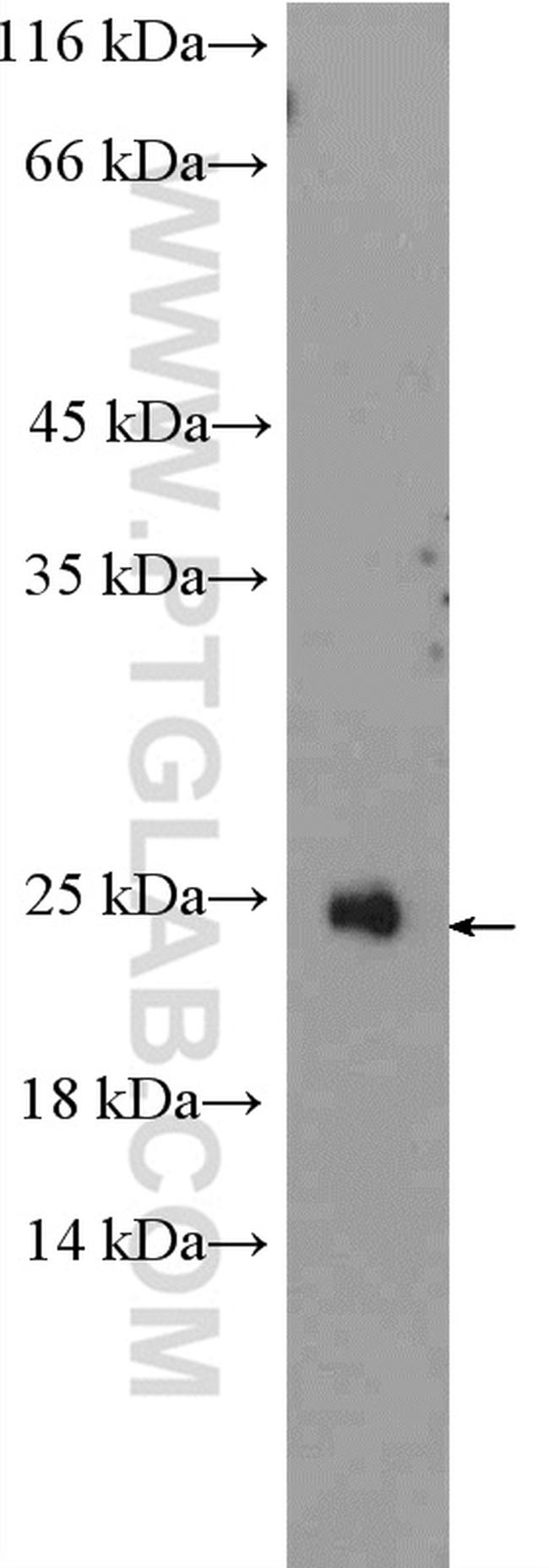 RAX2 Antibody in Western Blot (WB)