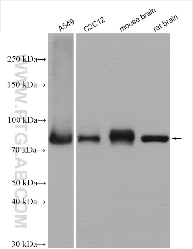 Calpain 2 Antibody in Western Blot (WB)