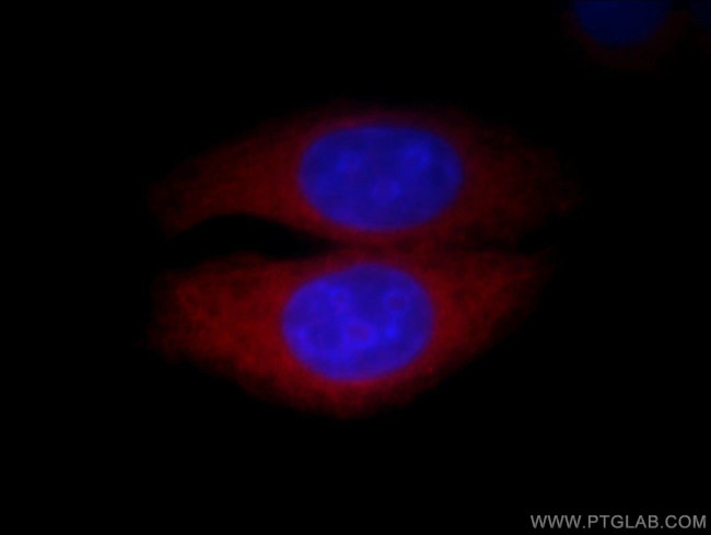 Calpain 2 Antibody in Immunocytochemistry (ICC/IF)