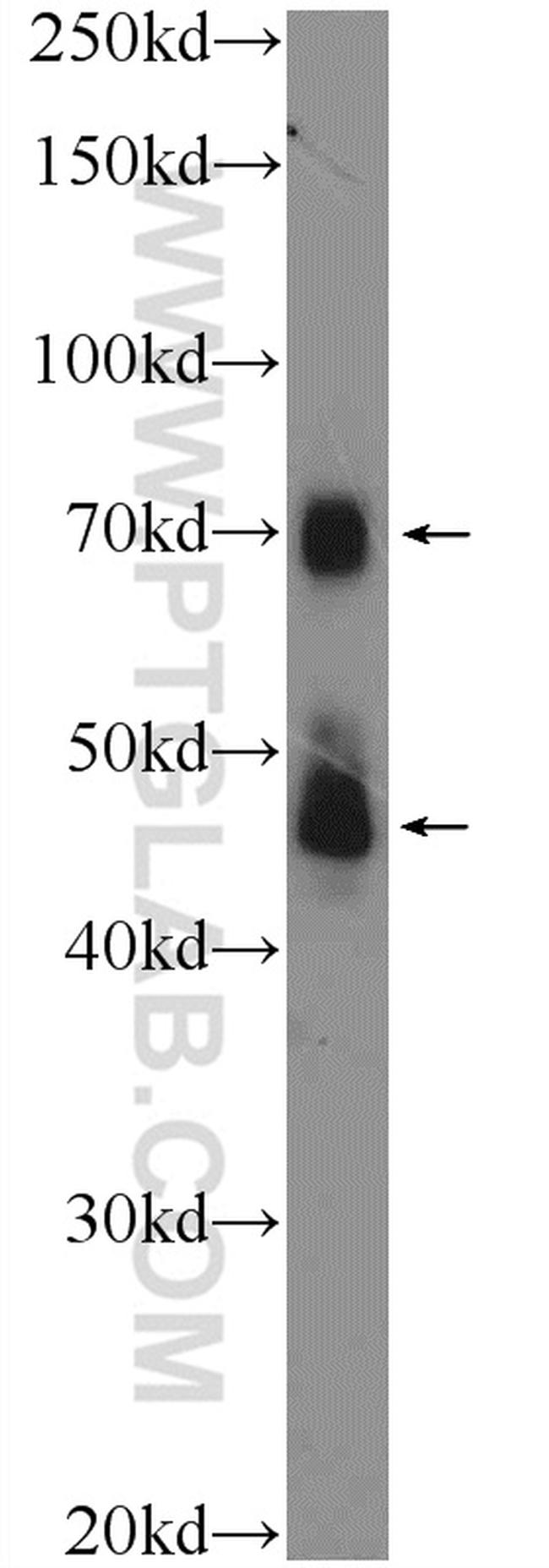 TRIM5 Antibody in Western Blot (WB)