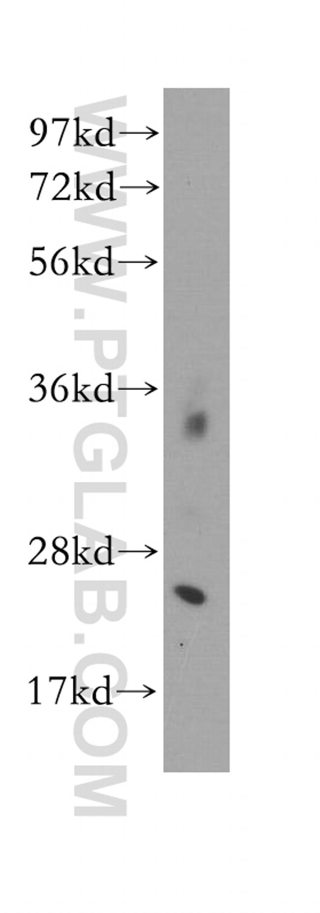 CALN1 Antibody in Western Blot (WB)