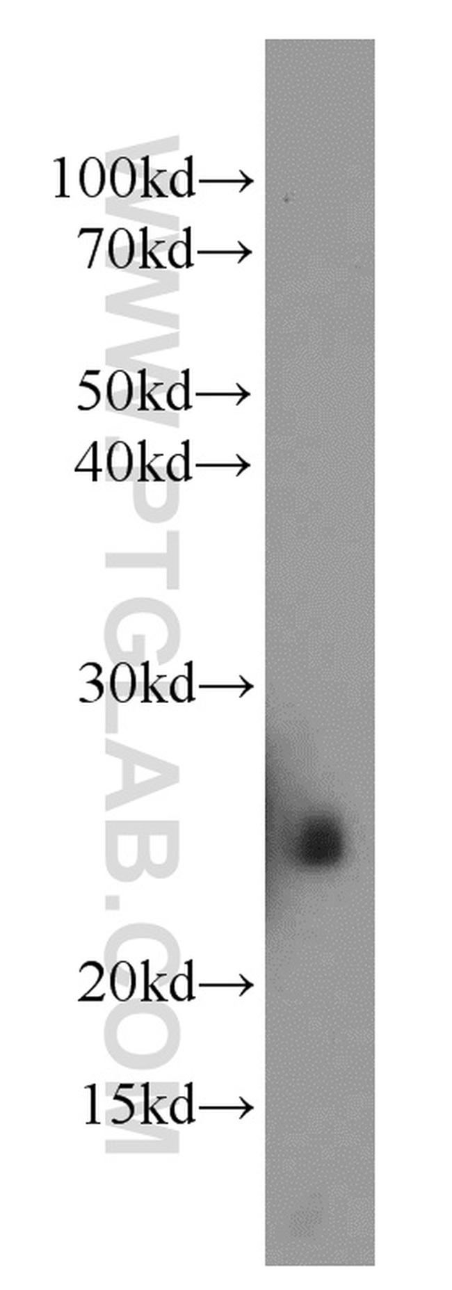 CALN1 Antibody in Western Blot (WB)