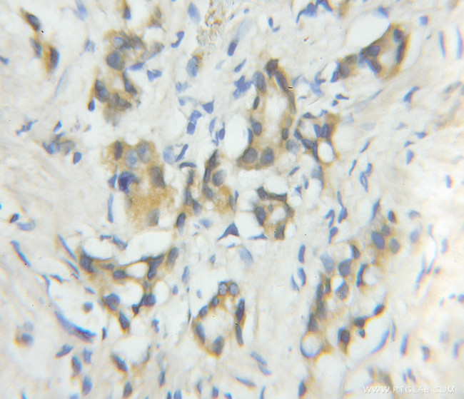 CALN1 Antibody in Immunohistochemistry (Paraffin) (IHC (P))