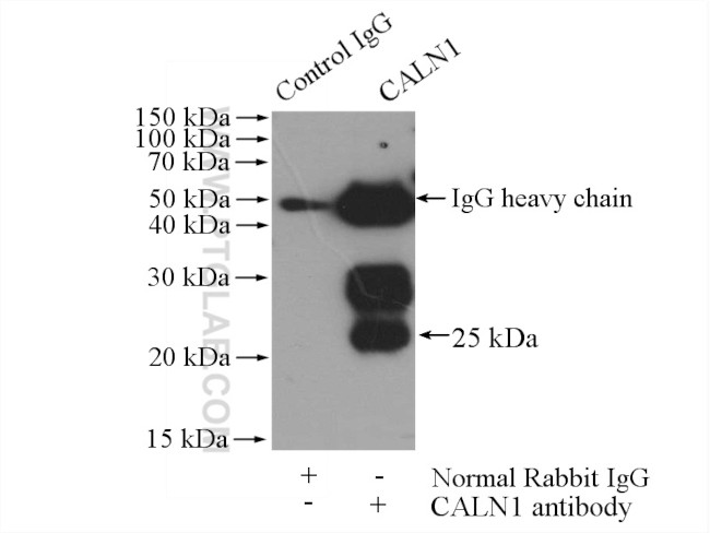 CALN1 Antibody in Immunoprecipitation (IP)